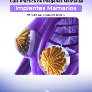 Guía de Ecografía Mamaria: Implantes