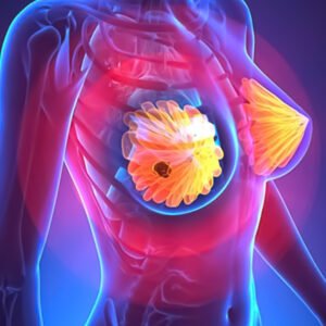 Curso de imagenes mamarias Imaged