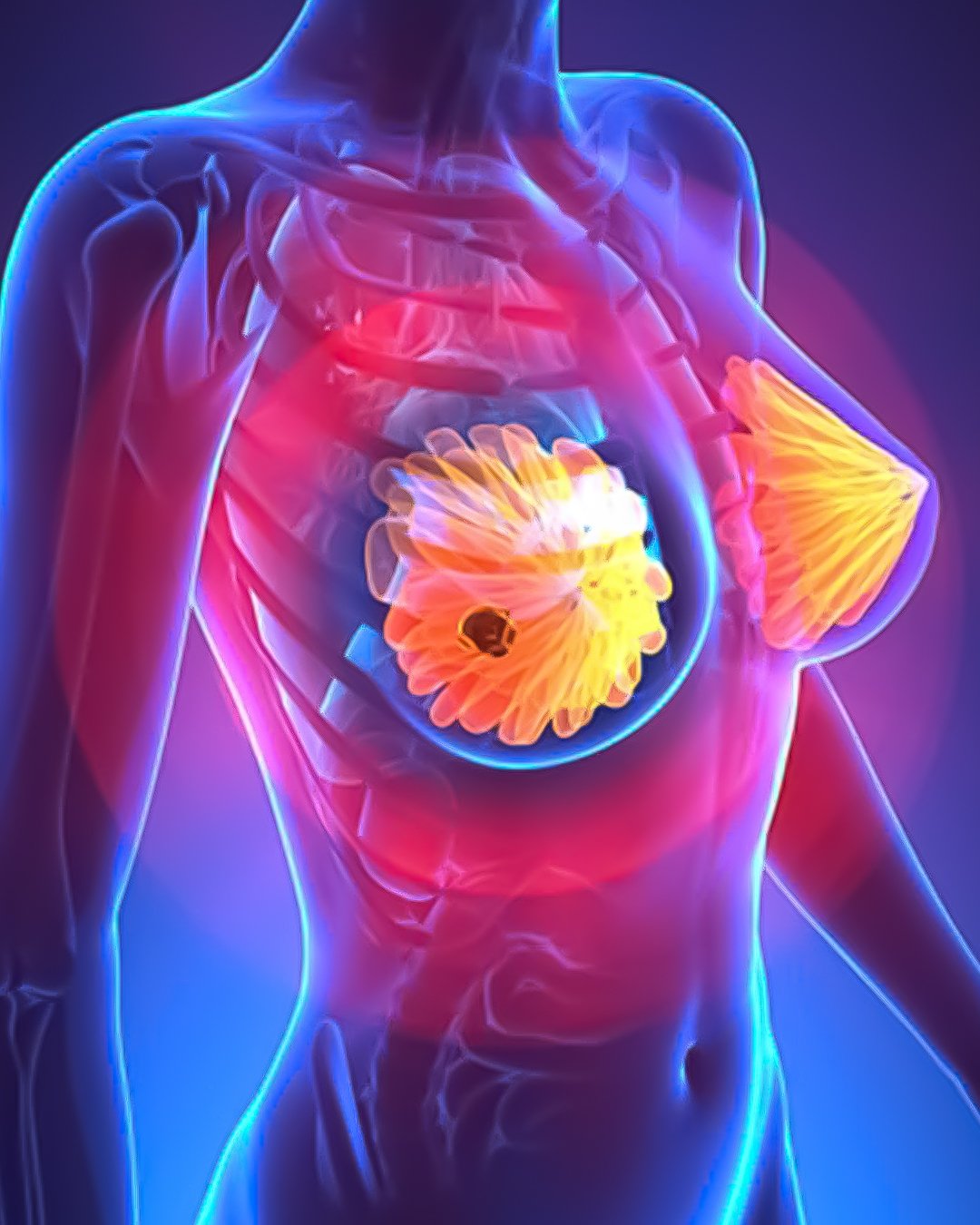 Curso de imagenes mamarias Imaged