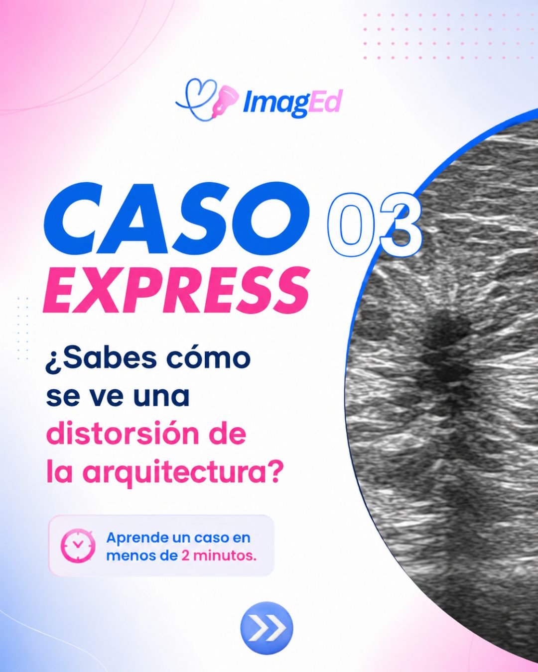 Portada Caso Express 03